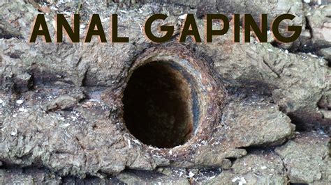 gaping anal gay